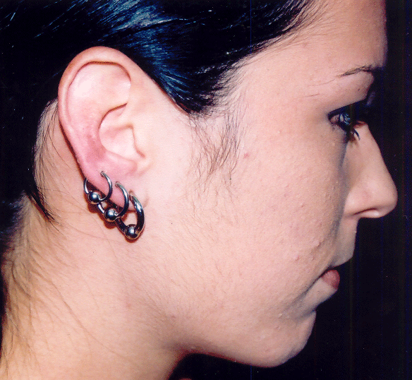 5.gif